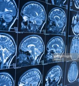 brain scans