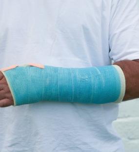 Man with broken arm in blue plaster cast