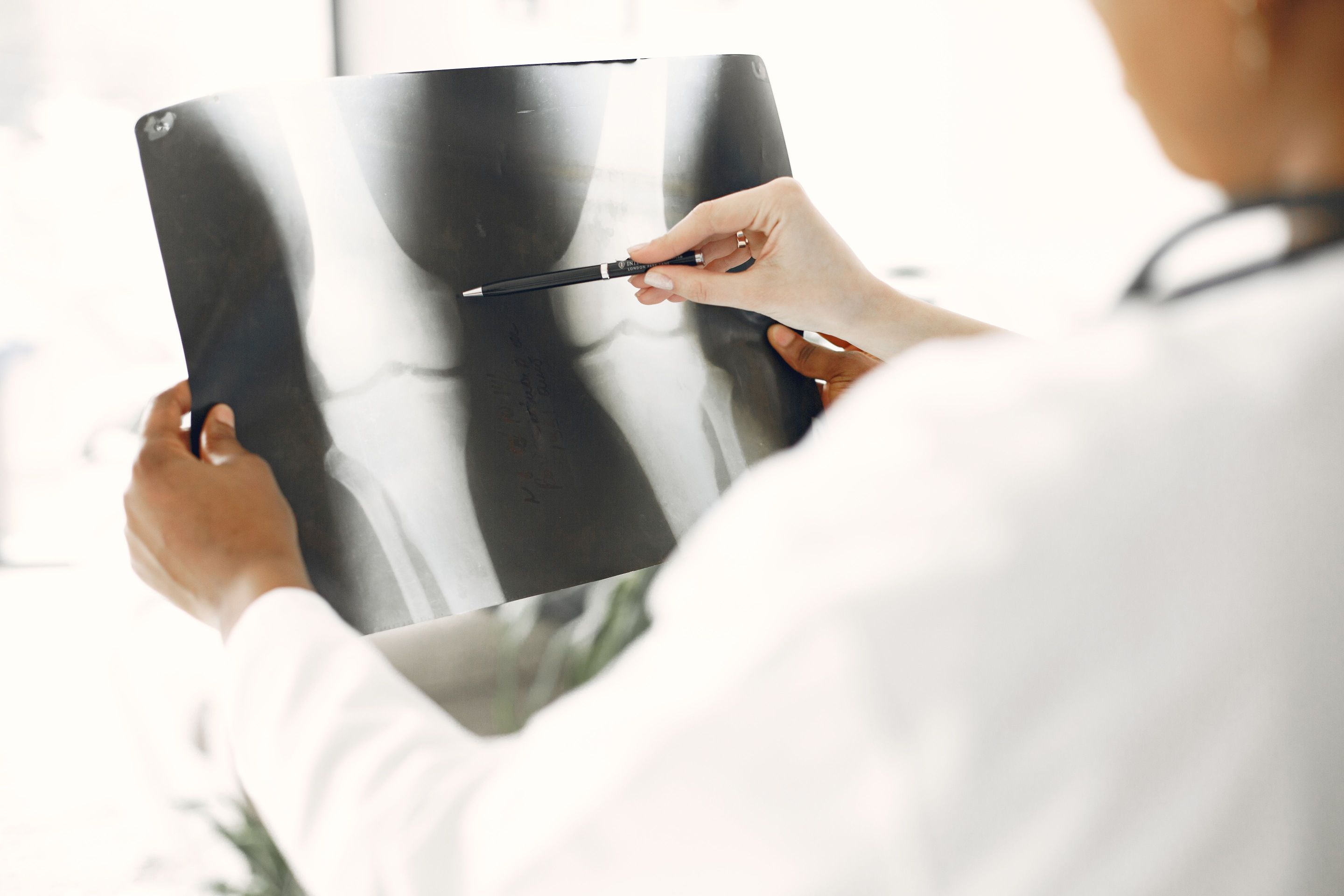 osteoporosis