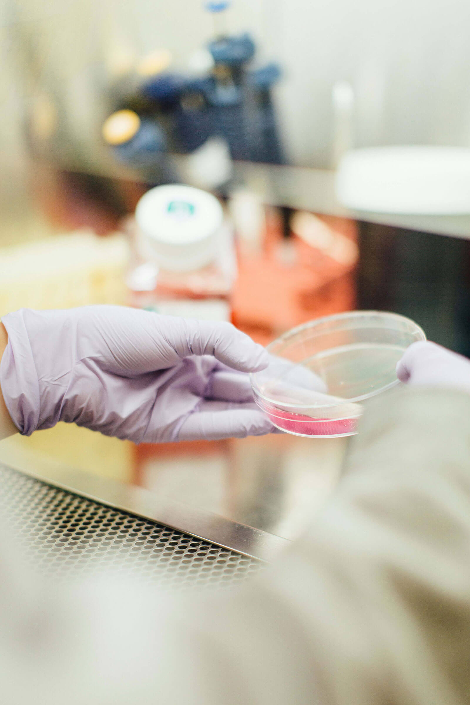 Scientist handling petri dish in laboratory with sterile gloves, biomedical research, microbiology testing, and scientific experimentation in healthcare lab.